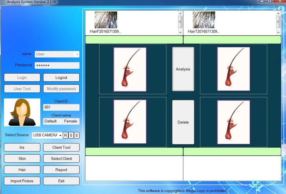 Iriscope 12MP Iris Analyzer Camera with Pro Iris Software