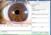 Iriscope 12MP Iris Analyzer Camera with Pro Iris Software